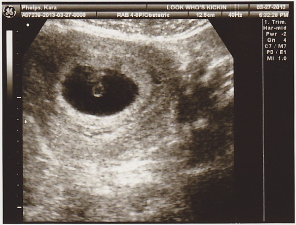 We’re Having A Baby…!